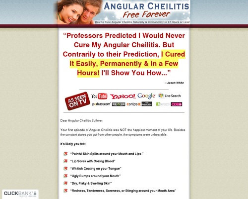 Angular Cheilitis Free Forever ~ Great Niche With No Competition! &#8211; uBetMobile.com