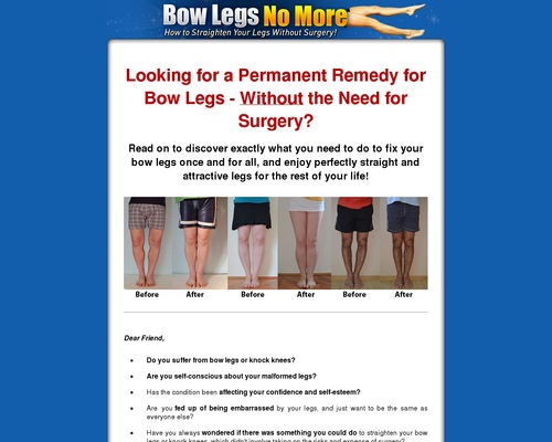 Bow Legs No More &#8211; Hot For Year 2020! &#8211; uBetMobile.com