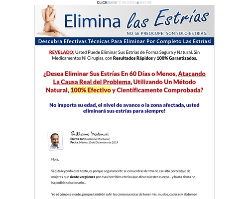 Elimina Las Estrías &#8211; Nuevo Nicho en Español! &#8211; uBetMobile.com