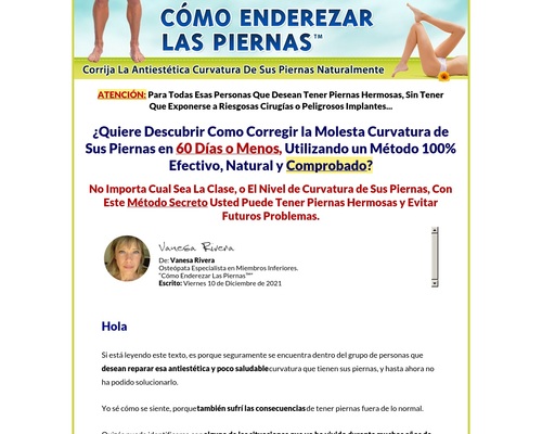 Enderezar Las Piernas. Único! Comisión 90%. &#8211; uBetMobile.com