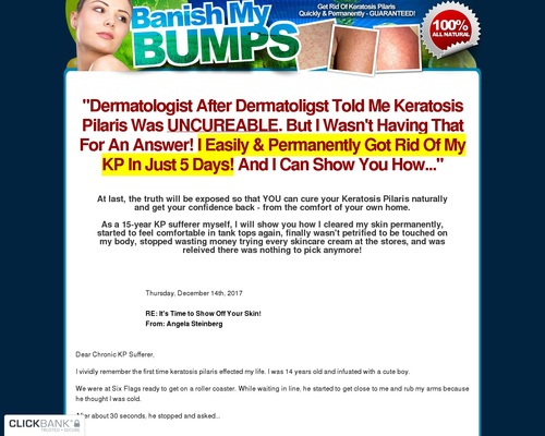 , Simple Keto Test – uBetMobile.com