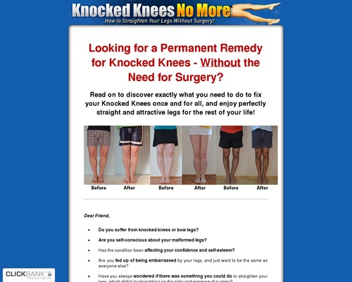 Knocked Knees No More &#8211; Hot For Year 2020! &#8211; uBetMobile.com