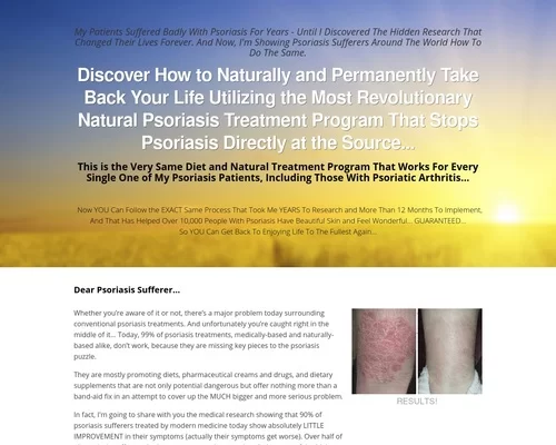 The Psoriasis Program &#8211; Permanent Psoriasis Solution By Dr Eric Bakker &#8211; uBetMobile.com