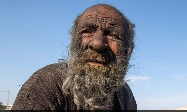 World’s Dirtiest Person Has Died At 94, Hadn’t Showered In 60 Years – OutKick – uBetMobile.com