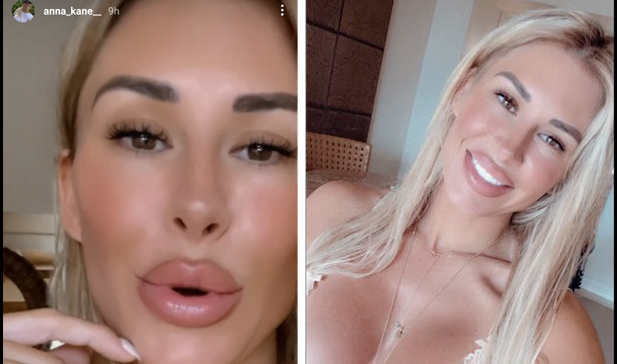 , Anna Kane Uses Ex-Husband Evander Kane&#8217;s Injury To Promote Her OnlyFans, Later Tries To Walk It Back – Mobile Betting Online &#8211; uBetMobile.com