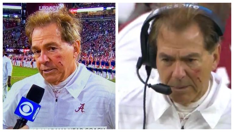 Nick Saban Ready For War, Coaches Iron Bowl With Bloody Face – Mobile Betting Online – uBetMobile.com