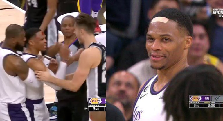 Russell Westbrook Tries To Combat Spurs Right after Challenging Foul Gashes His Head – uBetMobile.com