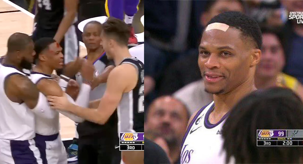 , Russell Westbrook Tries To Combat Spurs Right after Challenging Foul Gashes His Head &#8211; uBetMobile.com