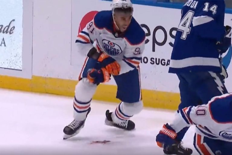 Skate Blade Slices Oilers’ Evander Kane In Frightening Harm – OutKick – uBetMobile.com