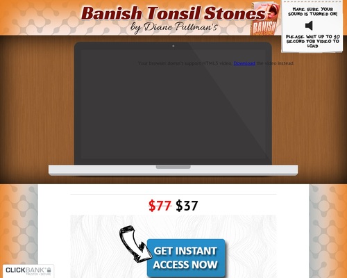 Tonsil Stones! *Up To $22/sale* New VSL! &#8211; uBetMobile.com