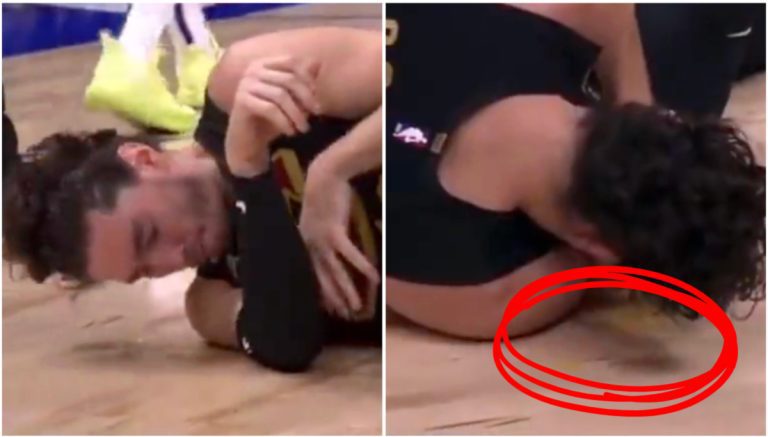 Yellow Blood Pours Out Of Cavs’ Hurt Player Cedi Osman – uBetMobile.com