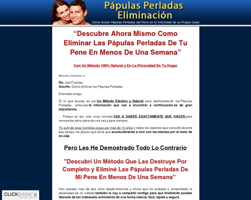 Como Remover Papulas Perladas, 75% Comision &#8211; uBetMobile.com