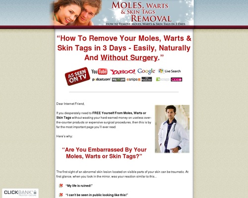 Moles, Warts &#038; Skin Tags Removal ~ 2020 Update &#8211; uBetMobile.com