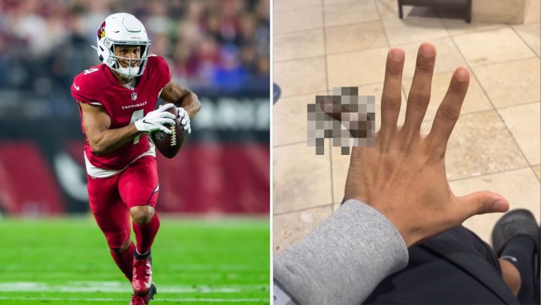 Cardinals WR Rondale Moore Posts Jaw-Dropping Image of Pinky Personal injury – Mobile Betting On the web – uBetMobile.com