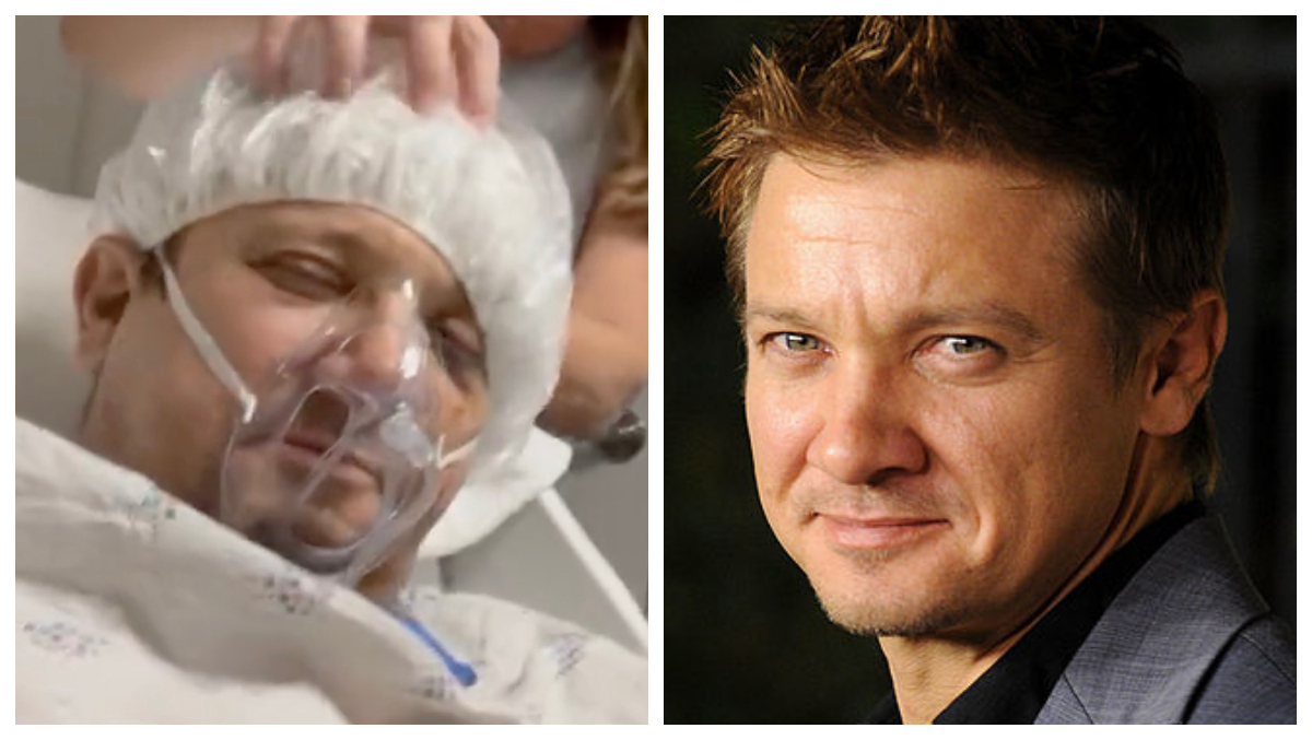 , Jeremy Renner&#8217;s Condition Nevertheless Very Severe: REPORT – Mobile Betting On the web &#8211; uBetMobile.com