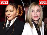 Plastic surgeons weigh-in on Madonna&#8217;s &#8216;unrecognizable&#8217; face: probably had a facelift, Botox, filler &#8211; uBetMobile.com